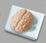 Brain mold